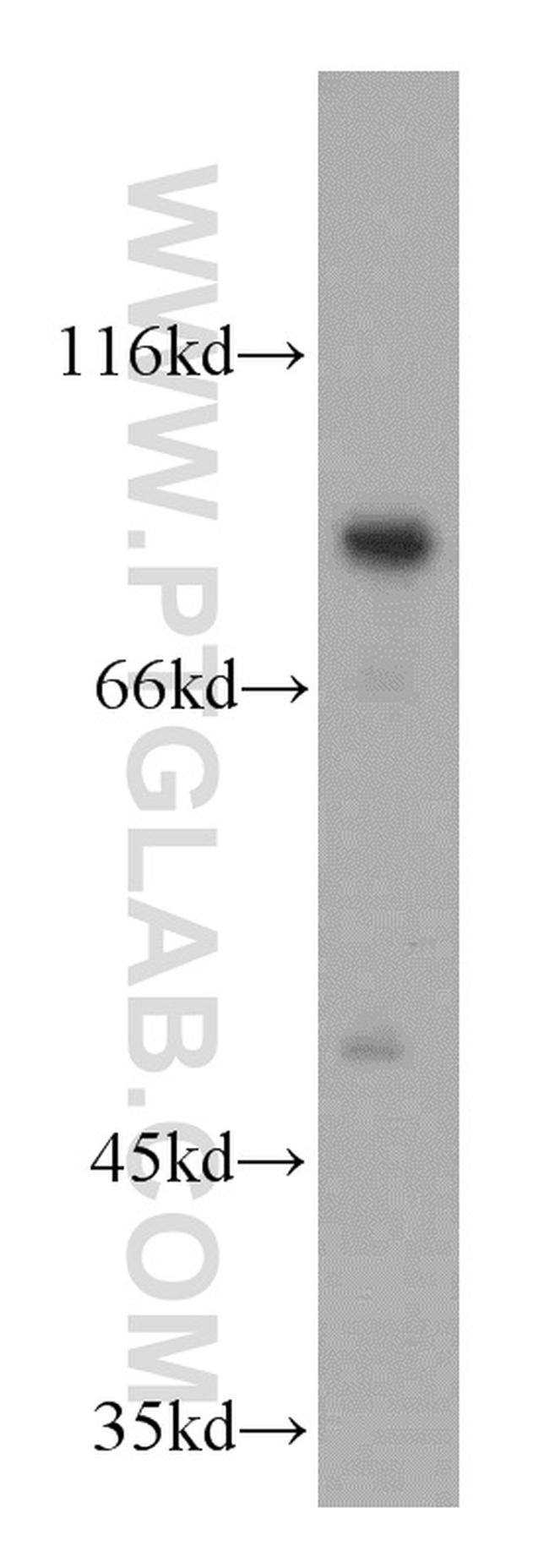 MARK1 Antibody in Western Blot (WB)