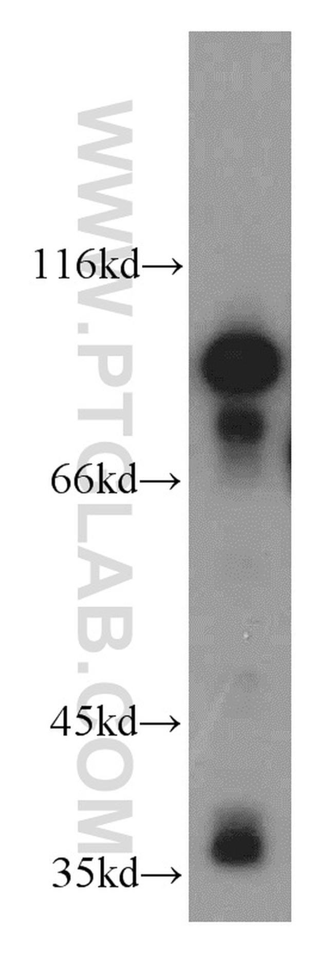 MARK1 Antibody in Western Blot (WB)