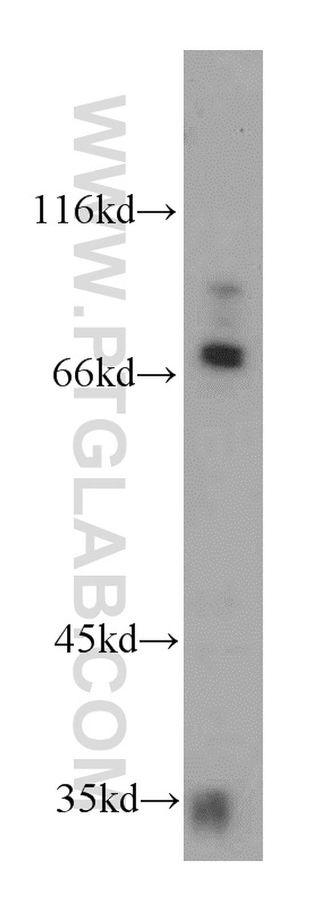 MARK1 Antibody in Western Blot (WB)