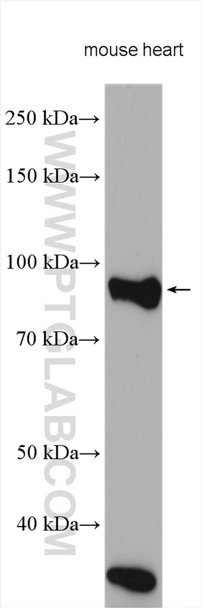 MARK1 Antibody in Western Blot (WB)