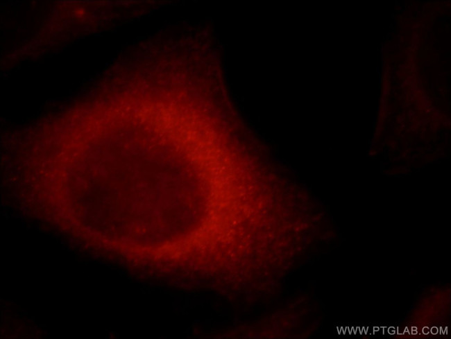 CYP26B1 Antibody in Immunocytochemistry (ICC/IF)