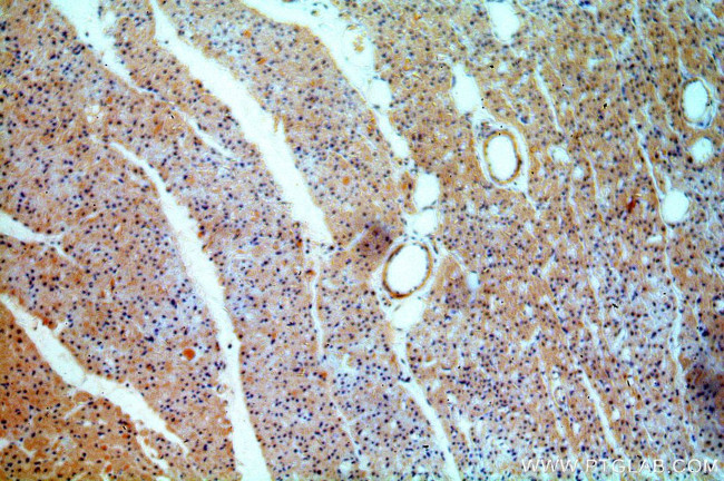 CYP26B1 Antibody in Immunohistochemistry (Paraffin) (IHC (P))