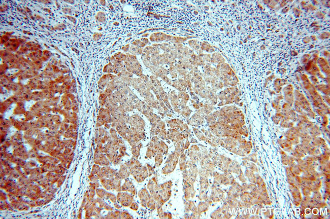 CYP26B1 Antibody in Immunohistochemistry (Paraffin) (IHC (P))