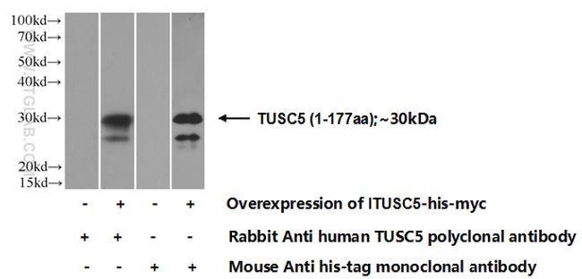 TUSC5 Antibody in Western Blot (WB)