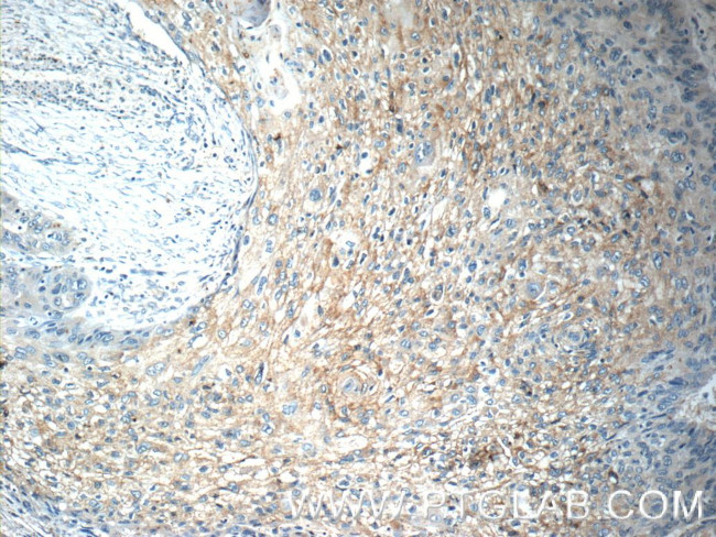 TOAG1 Antibody in Immunohistochemistry (Paraffin) (IHC (P))