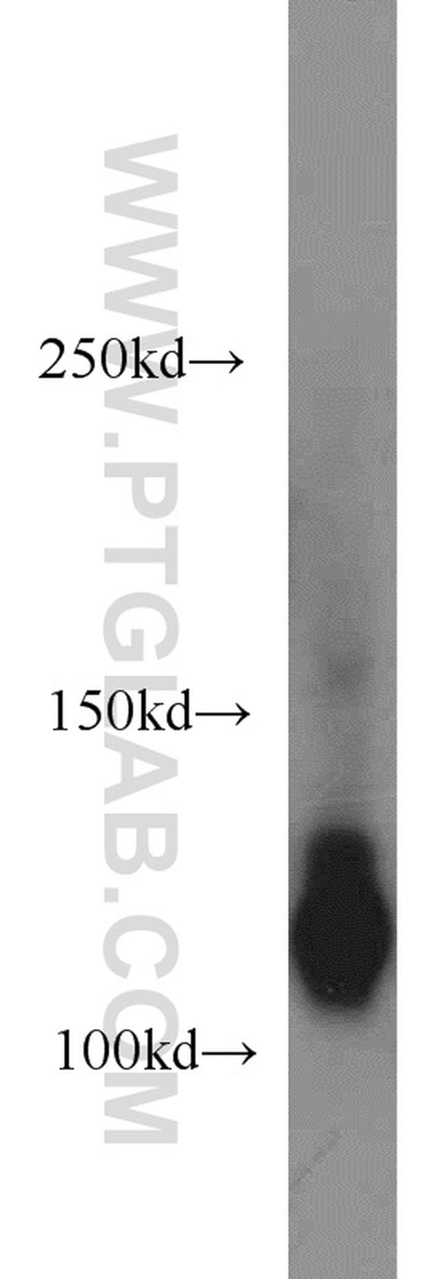 ATP8A1 Antibody in Western Blot (WB)