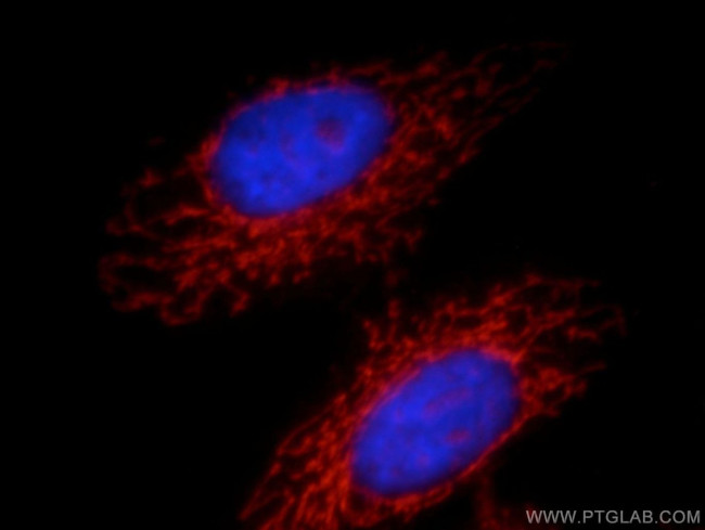 NAGS Antibody in Immunocytochemistry (ICC/IF)