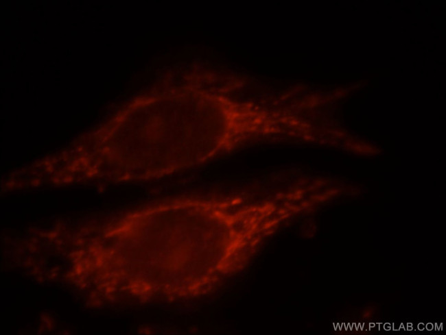 NAGS Antibody in Immunocytochemistry (ICC/IF)