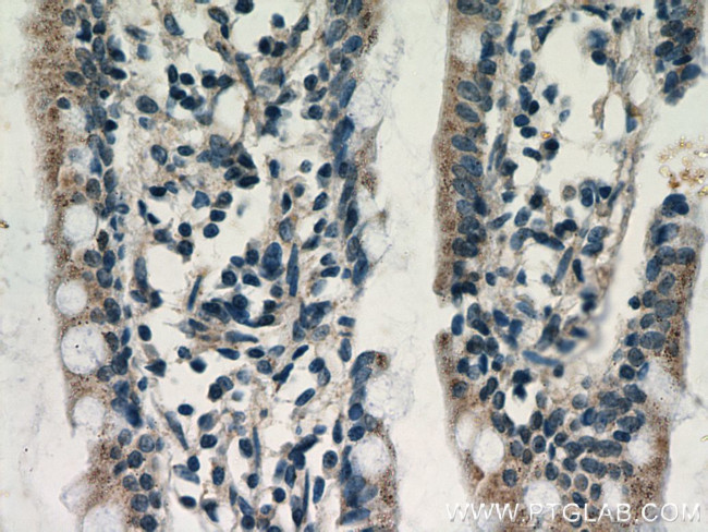 NAGS Antibody in Immunohistochemistry (Paraffin) (IHC (P))