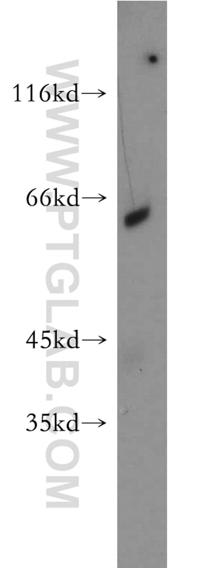 NAGS Antibody in Western Blot (WB)
