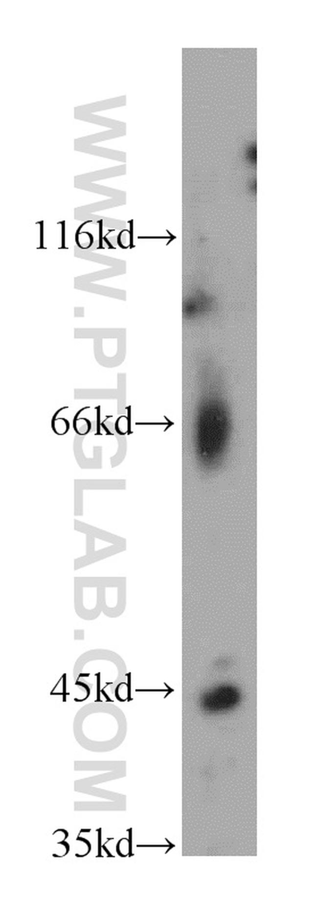 LHX5 Antibody in Western Blot (WB)