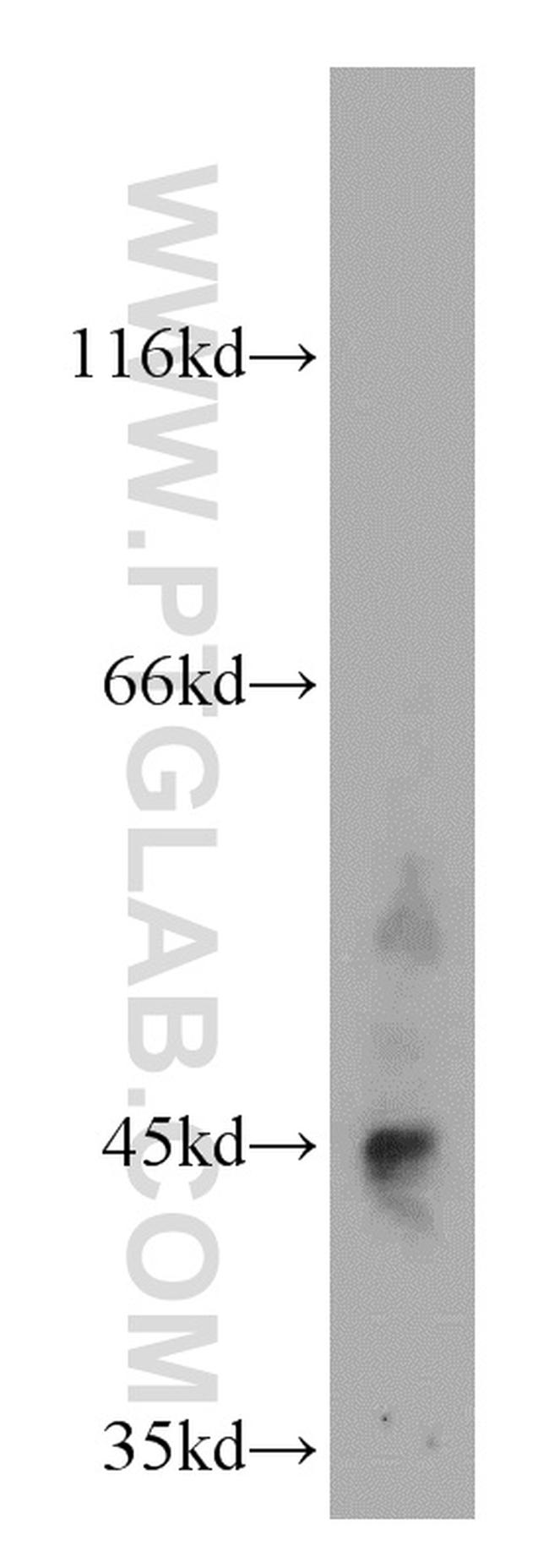 LHX5 Antibody in Western Blot (WB)