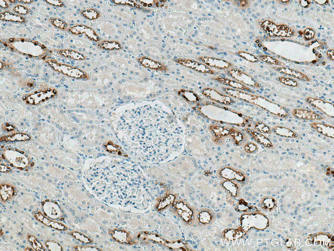 ATP6V0A4 Antibody in Immunohistochemistry (Paraffin) (IHC (P))