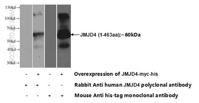 JMJD4 Antibody in Western Blot (WB)