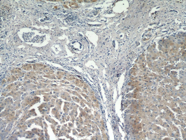 MOGAT1 Antibody in Immunohistochemistry (Paraffin) (IHC (P))