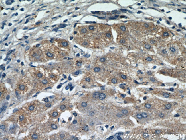 MOGAT1 Antibody in Immunohistochemistry (Paraffin) (IHC (P))