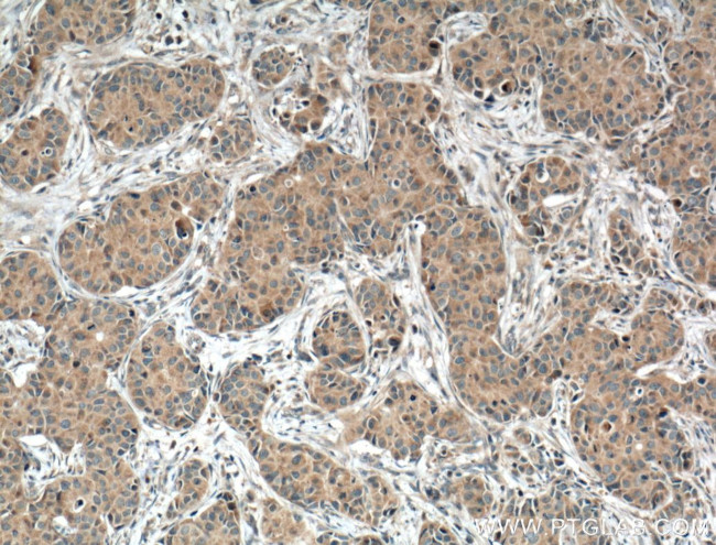 TNFR1 Antibody in Immunohistochemistry (Paraffin) (IHC (P))