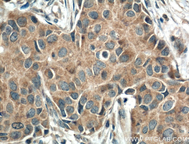 TNFR1 Antibody in Immunohistochemistry (Paraffin) (IHC (P))