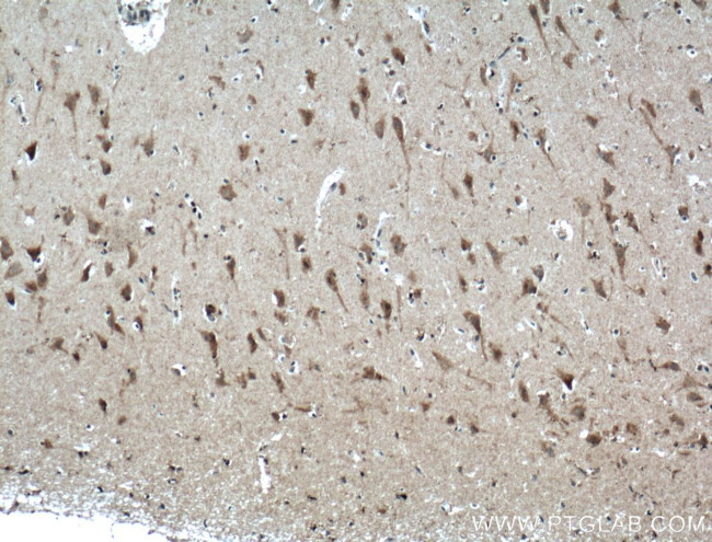 TNFR1 Antibody in Immunohistochemistry (Paraffin) (IHC (P))