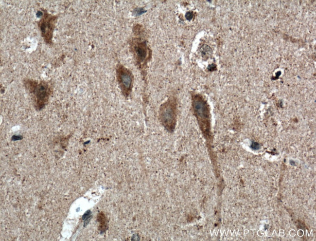 TNFR1 Antibody in Immunohistochemistry (Paraffin) (IHC (P))