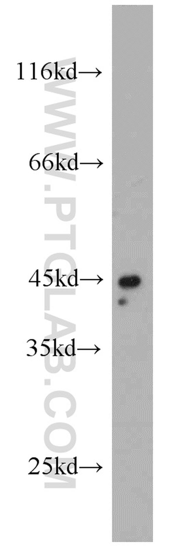 TNFR1 Antibody in Western Blot (WB)