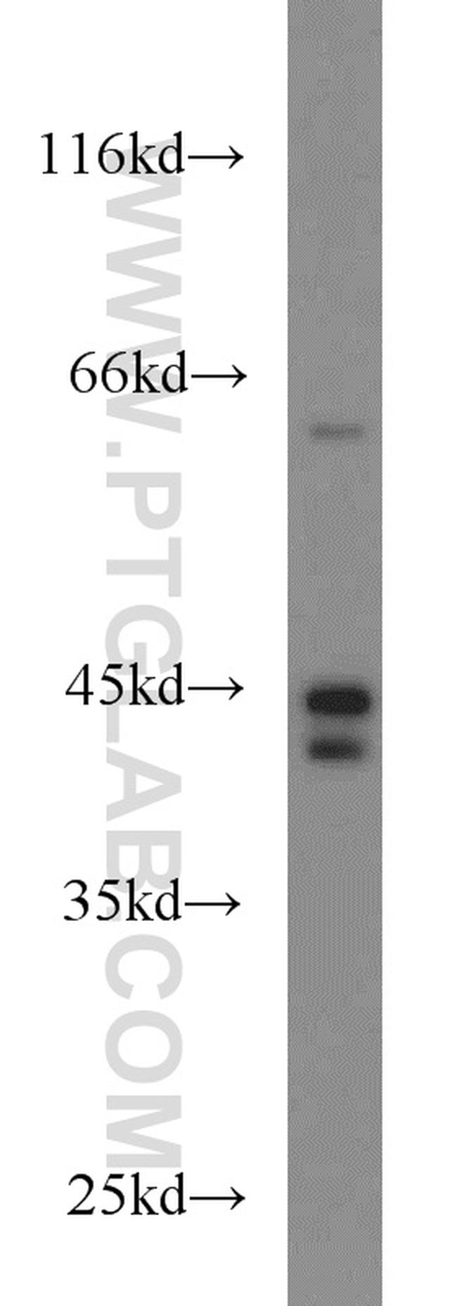 TNFR1 Antibody in Western Blot (WB)