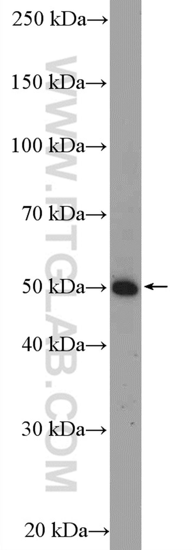 TNFR1 Antibody in Western Blot (WB)