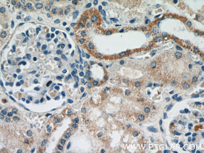 CYP24A1 Antibody in Immunohistochemistry (Paraffin) (IHC (P))