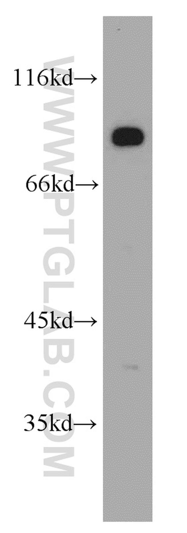 DLL4 Antibody in Western Blot (WB)