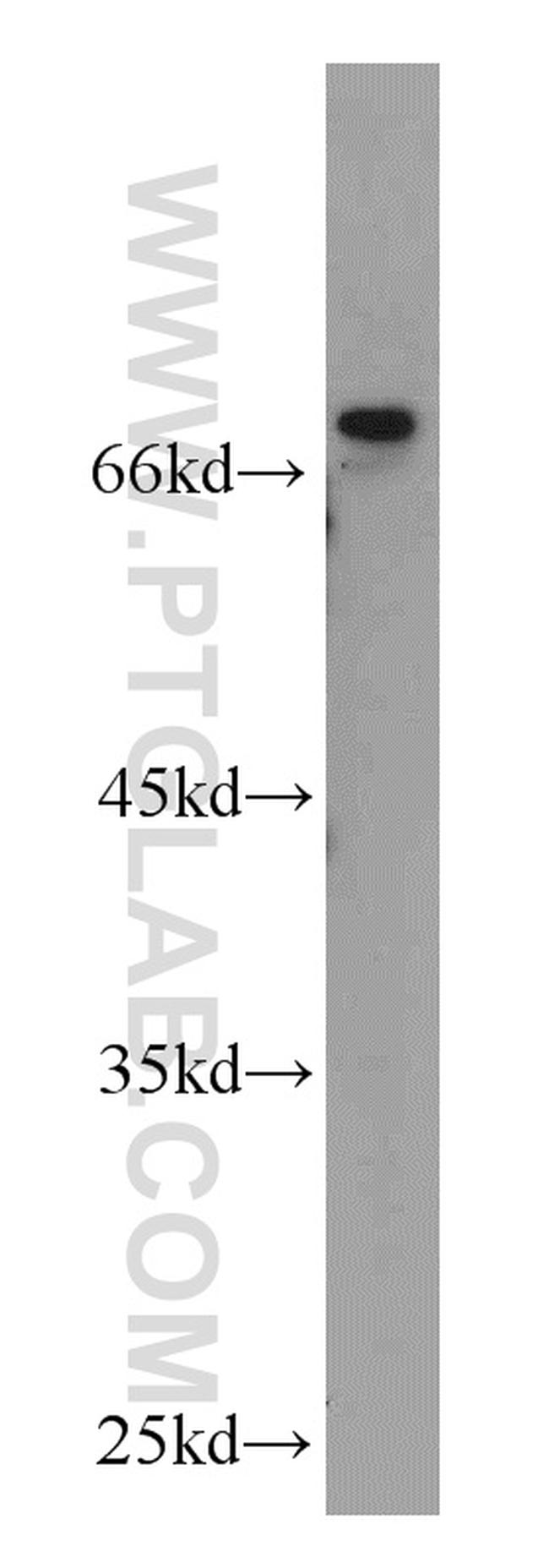 DLL4 Antibody in Western Blot (WB)