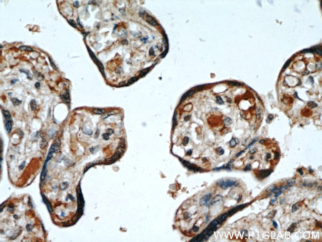 OGFOD2 Antibody in Immunohistochemistry (Paraffin) (IHC (P))