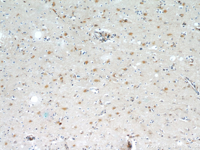 OGFOD2 Antibody in Immunohistochemistry (Paraffin) (IHC (P))