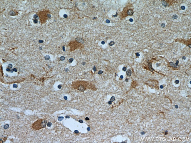 OGFOD2 Antibody in Immunohistochemistry (Paraffin) (IHC (P))