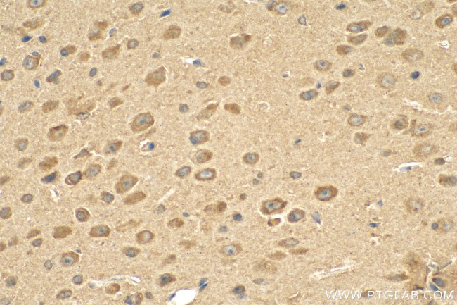 OGFOD2 Antibody in Immunohistochemistry (Paraffin) (IHC (P))