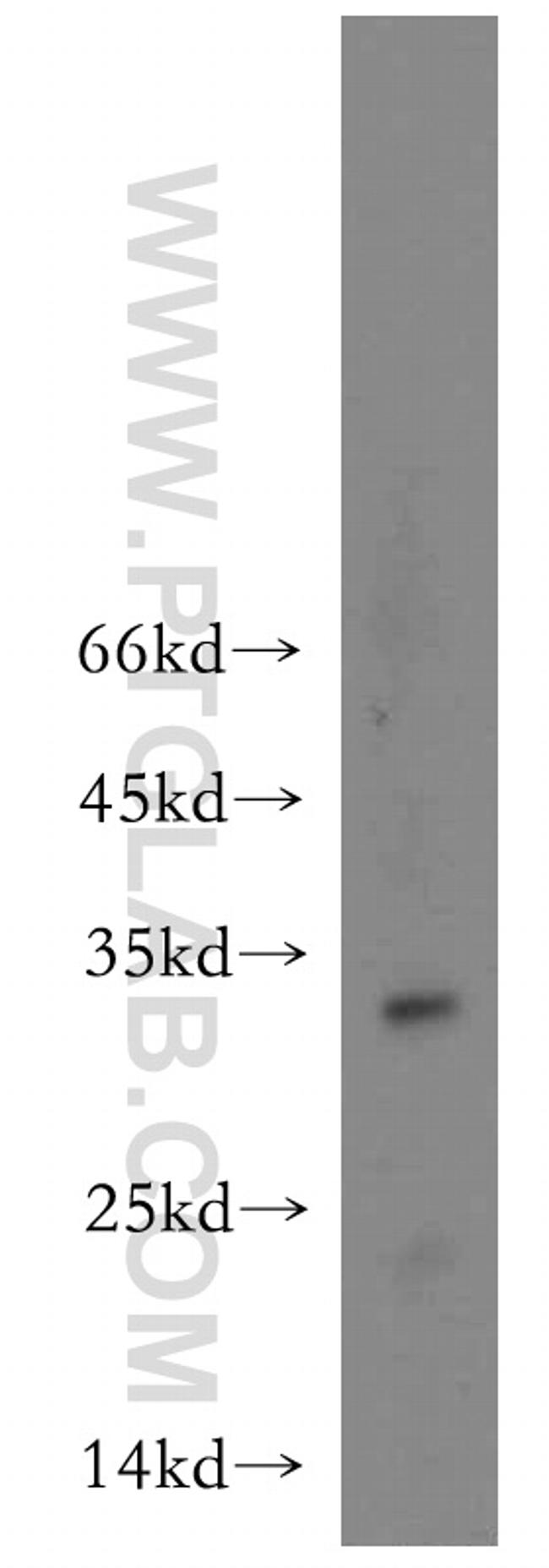 OGFOD2 Antibody in Western Blot (WB)