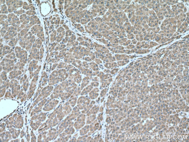 DNA2 Antibody in Immunohistochemistry (Paraffin) (IHC (P))