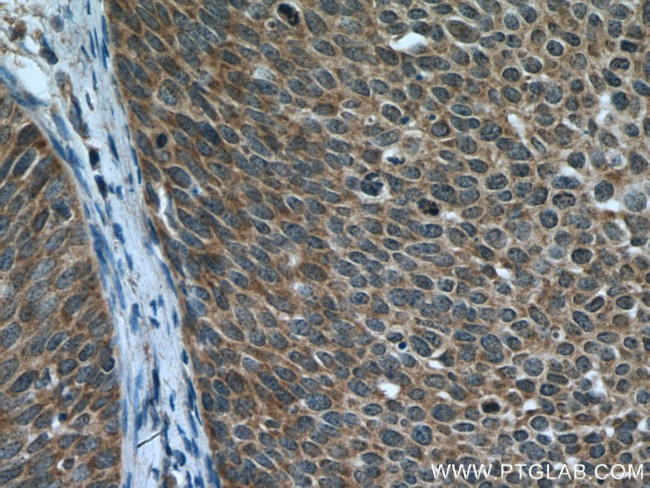 DNA2 Antibody in Immunohistochemistry (Paraffin) (IHC (P))