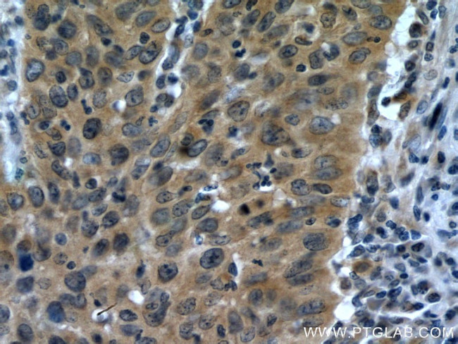 DNA2 Antibody in Immunohistochemistry (Paraffin) (IHC (P))