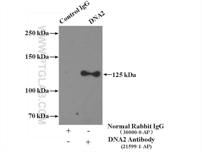 DNA2 Antibody in Immunoprecipitation (IP)