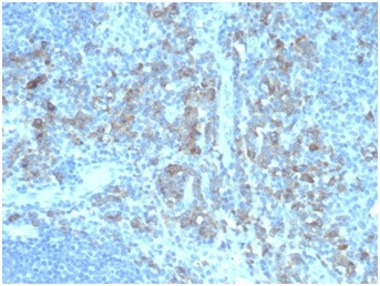 ALDH1A1 (Aldehyde Dehydrogenase 1A1) Antibody in Immunohistochemistry (Paraffin) (IHC (P))