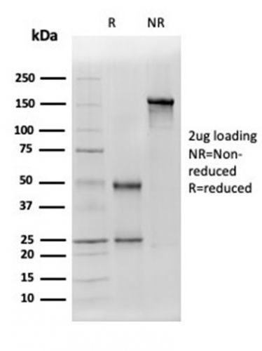 ALDH1A1 (Aldehyde Dehydrogenase 1A1) Antibody in SDS-PAGE (SDS-PAGE)