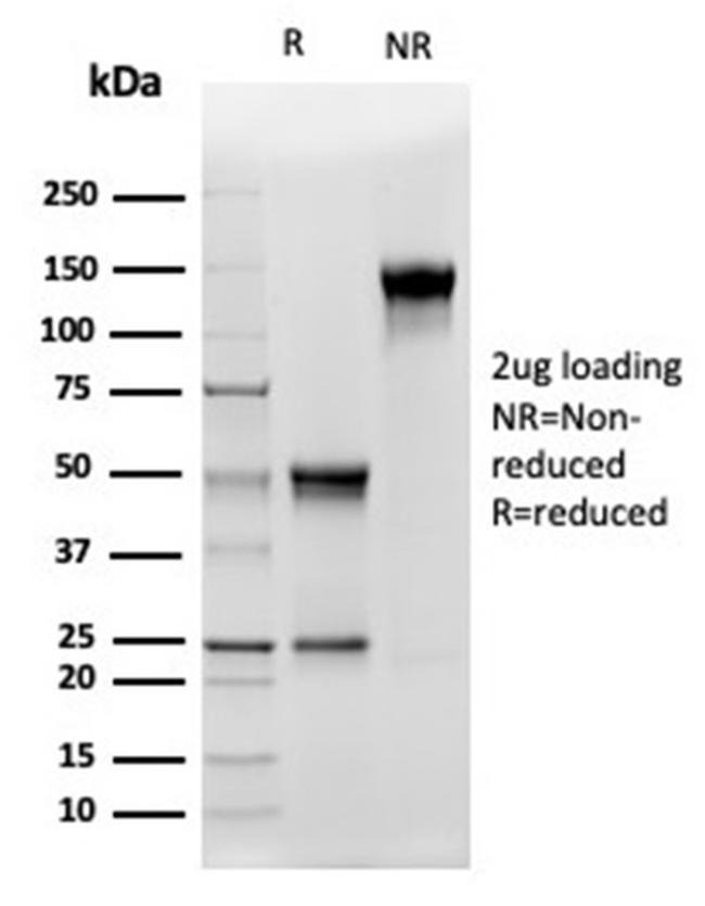 ALDH1A1 (Aldehyde Dehydrogenase 1A1) Antibody in SDS-PAGE (SDS-PAGE)