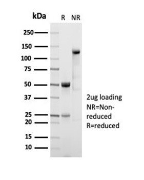 ALDH1A1 (Aldehyde Dehydrogenase 1A1) Antibody in SDS-PAGE (SDS-PAGE)