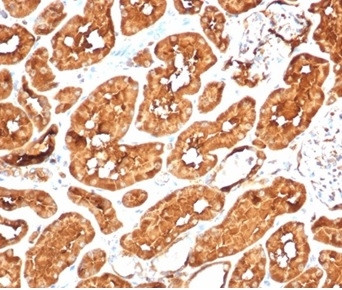 ALDH1A1 (Aldehyde Dehydrogenase 1A1) Antibody in Immunohistochemistry (Paraffin) (IHC (P))