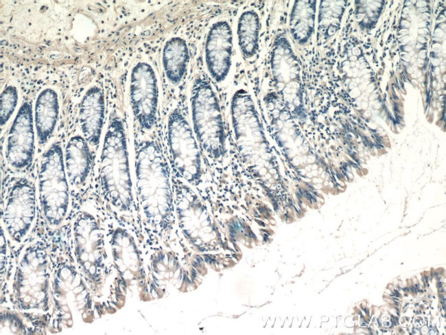 TTC7A Antibody in Immunohistochemistry (Paraffin) (IHC (P))