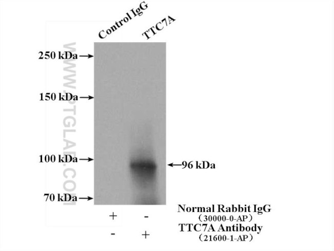 TTC7A Antibody in Immunoprecipitation (IP)