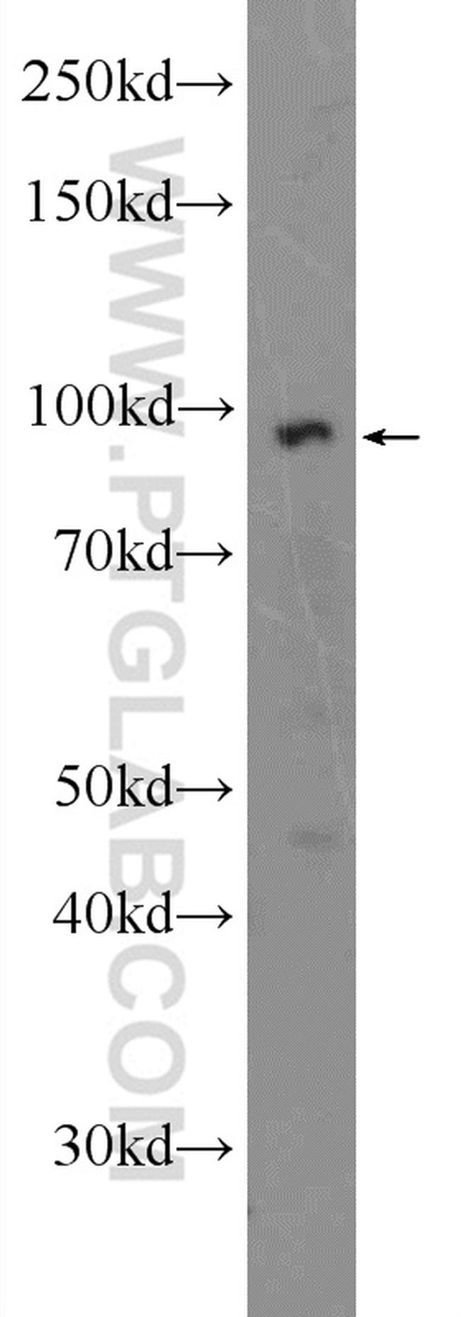 TTC7A Antibody in Western Blot (WB)