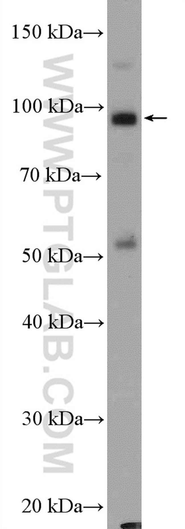 TTC7A Antibody in Western Blot (WB)