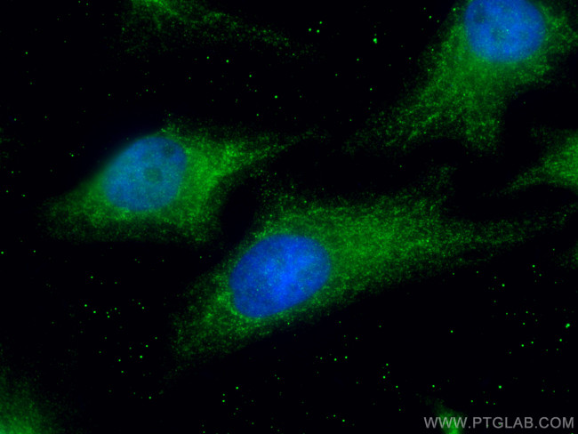 MRPL28 Antibody in Immunocytochemistry (ICC/IF)