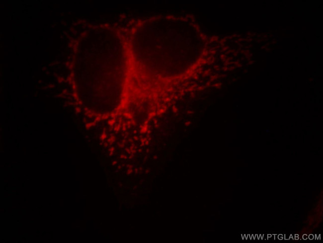 MRPL28 Antibody in Immunocytochemistry (ICC/IF)